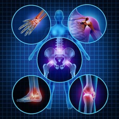 https://centurygh.com/product/arthritis-and-sciatica-treatment/