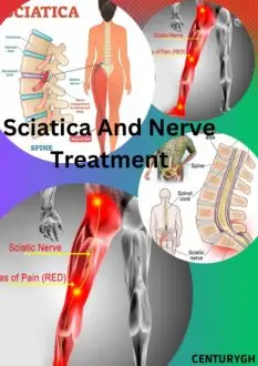 "how to treat sciatica and nerve pain